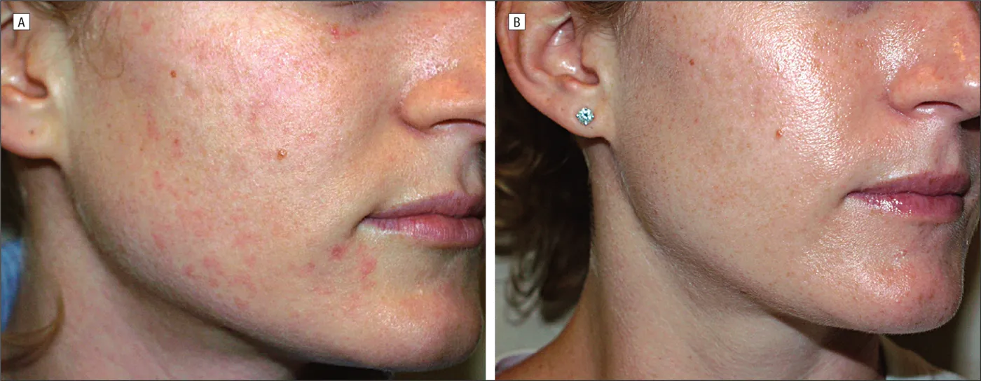 Evolve Esthetique Clinics