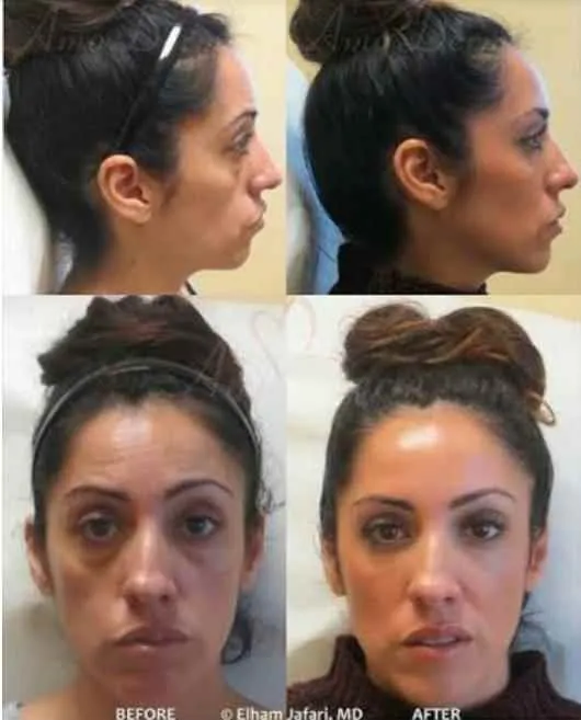 Evolve Esthetique Clinics