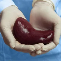 Kidney Transplant Hospital Kidney Transplant Hospital