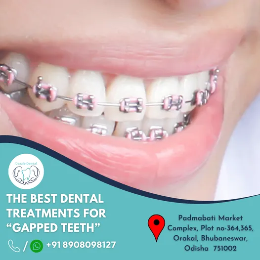 Dazzle Dental Care Dazzle Dental Care