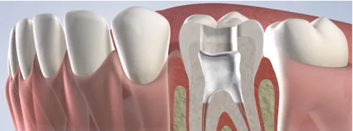 Jamnagar Dental Care Centre