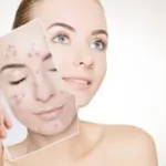 ACE Clinic - Dr Tanveer Fatima MBBS,MD Dermatology