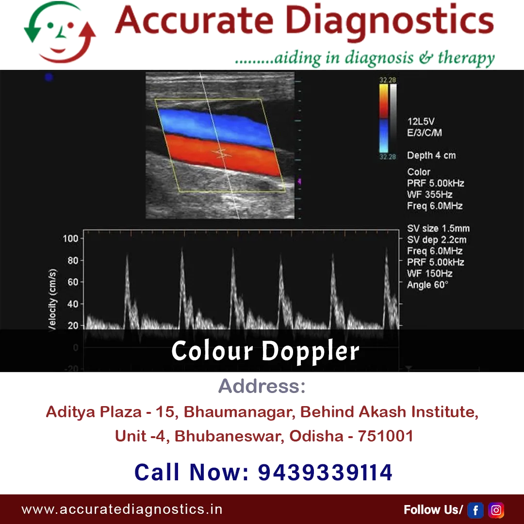 Accurate Diagnostics