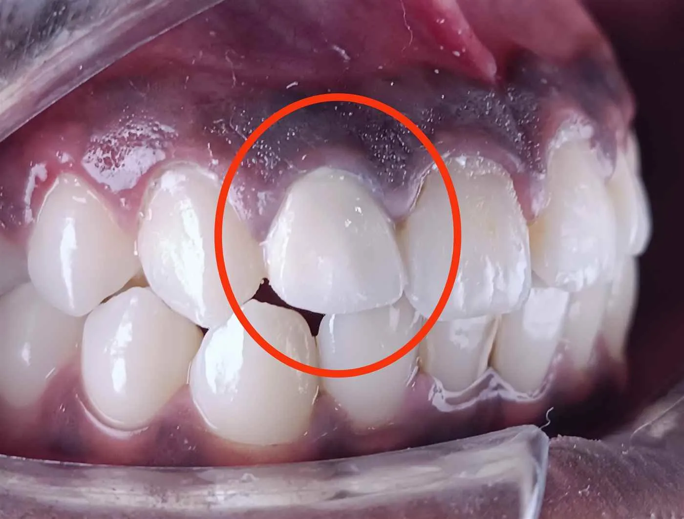 Dr. Harish Root Canal and Cosmetic Centre