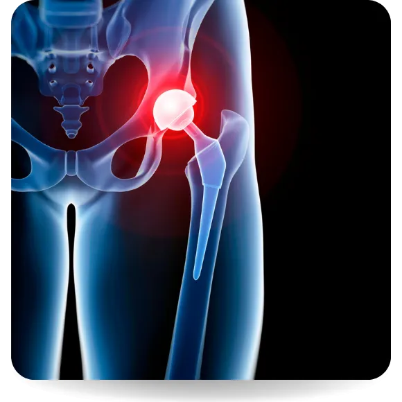 Elite Orthopaedics Elite Orthopaedics