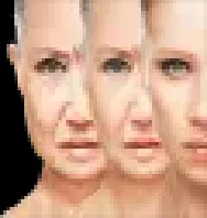 Stem Cell Therapy Center Stem Cell Therapy Center