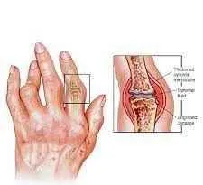 Stem Cell Therapy Center Stem Cell Therapy Center