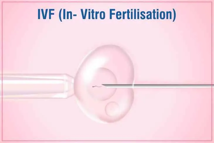 Eeshan IVF Eeshan IVF