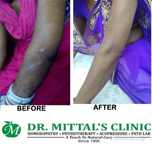 Dr. Mittals Clinic Dr. Mittals Clinic