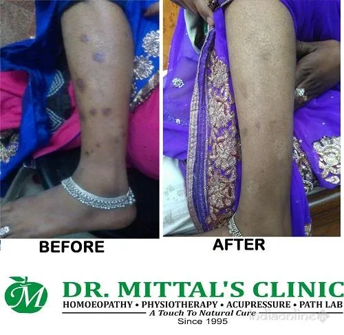 Dr. Mittals Clinic Dr. Mittals Clinic