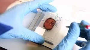 Trulife Diagnostics Trulife Diagnostics