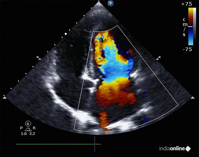Trulife Diagnostics Trulife Diagnostics