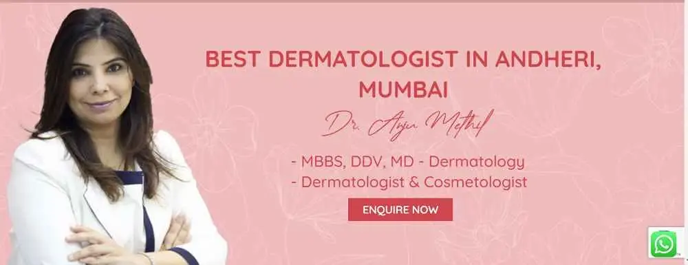 Best Dermatologist in Andheri Mumbai Dr Anju Methil