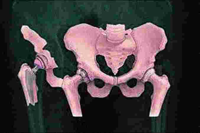 Care n Cure Clinic - Physiotherapist & Chiropractor Care n Cure Clinic - Physiotherapist & Chiropractor