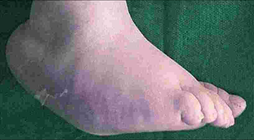 Care n Cure Clinic - Physiotherapist & Chiropractor