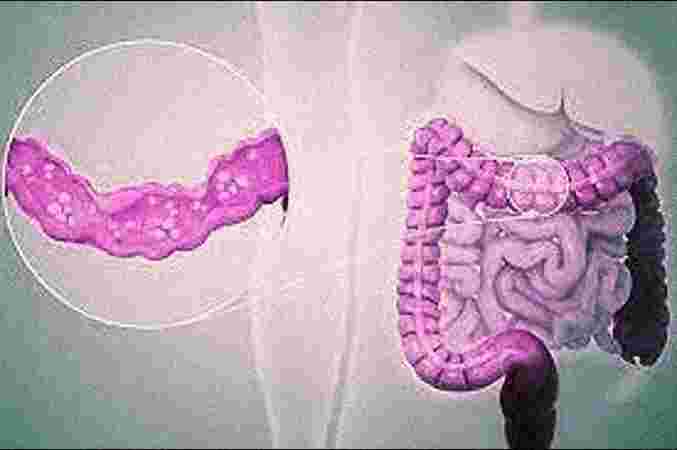 Care n Cure Clinic - Physiotherapist & Chiropractor