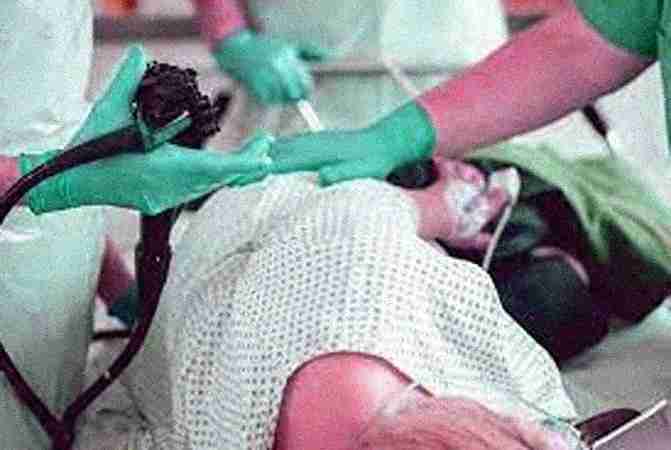 Colonoscopy Colonoscopy