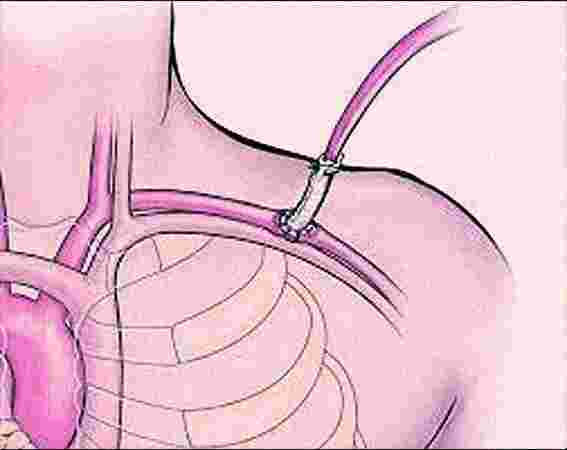 Anvaya Healthcare Gurgaon Anvaya Healthcare Gurgaon