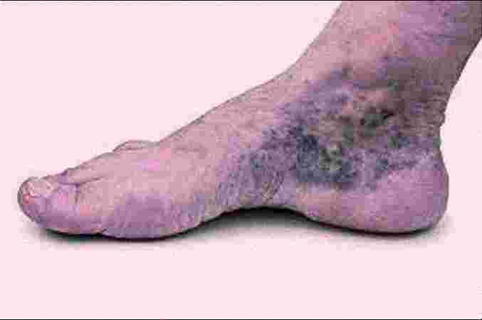 Care n Cure Clinic - Physiotherapist & Chiropractor