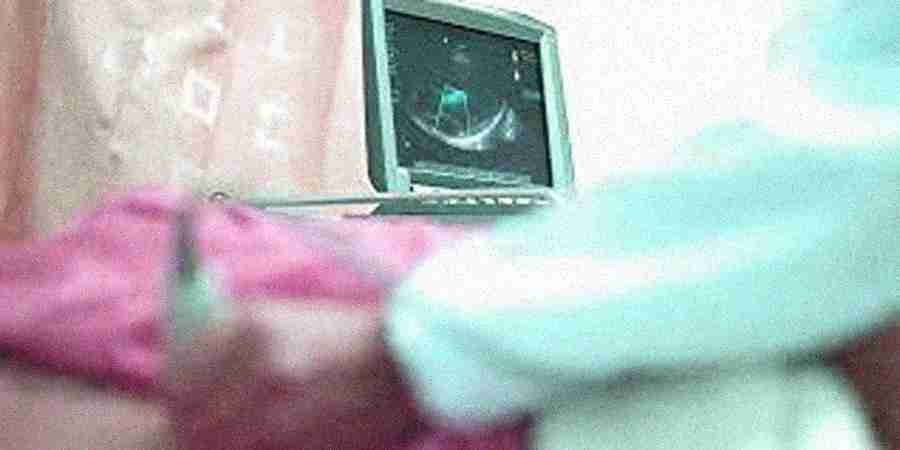 Echocardiography Echocardiography