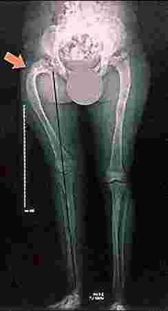 Care n Cure Clinic - Physiotherapist & Chiropractor