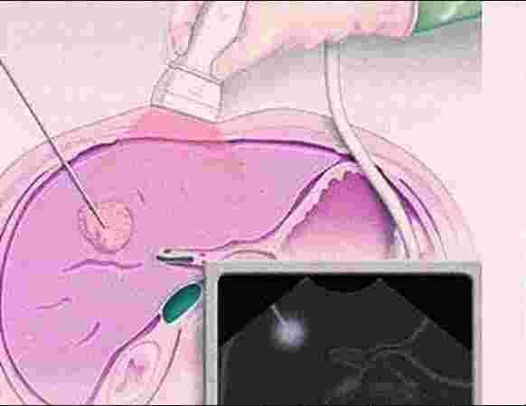 Anvaya Healthcare Gurgaon Anvaya Healthcare Gurgaon