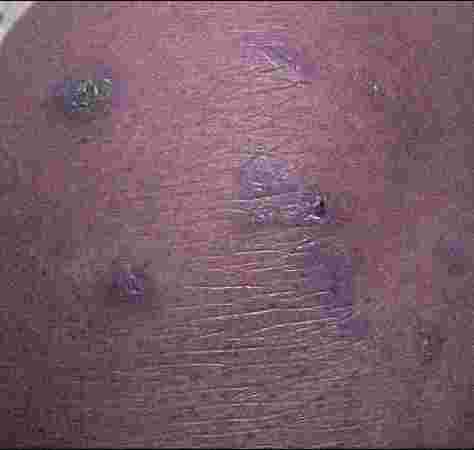 Dr Bulu Nahak ENT Specialist in Bhubaneswar Dr Bulu Nahak ENT Specialist in Bhubaneswar