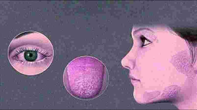 Aline Dent Aline Dent