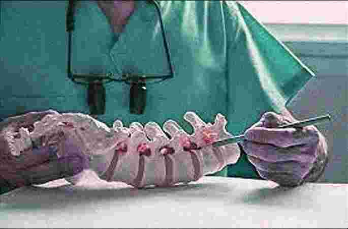 NEXIN HEALTH NEXIN HEALTH