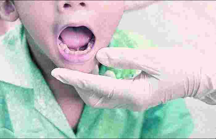 Dr Bulu Nahak ENT Specialist in Bhubaneswar