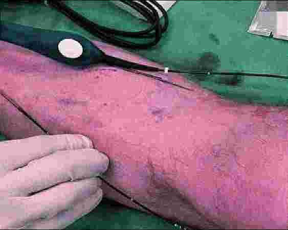 Hope Hospital Pimpri Chinchwad