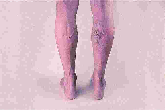 Anvaya Healthcare Gurgaon